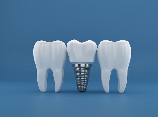 How Traditional Dentures Can Affect Your Jawbone Over Time