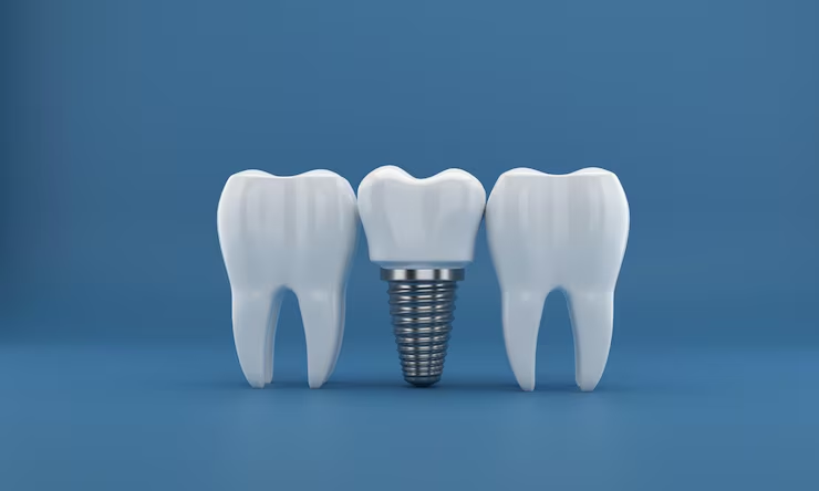 How Traditional Dentures Can Affect Your Jawbone Over Time